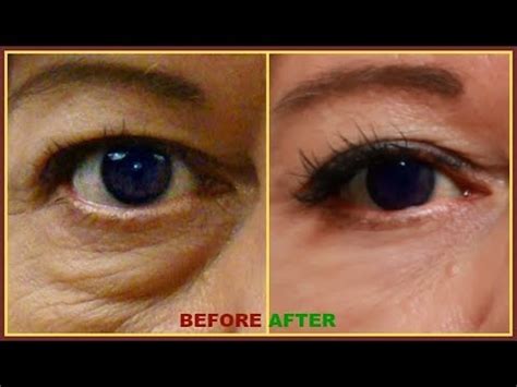 fake bags under eyes|crisco for under eye bags.